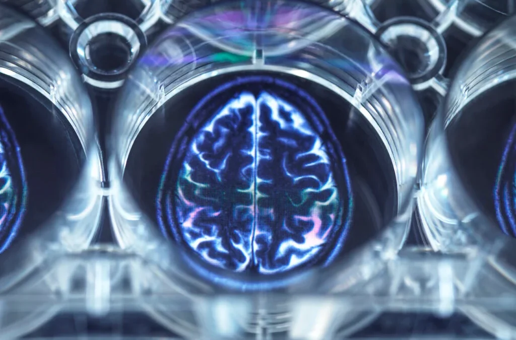 How does Psychotherapy effect the Brain?