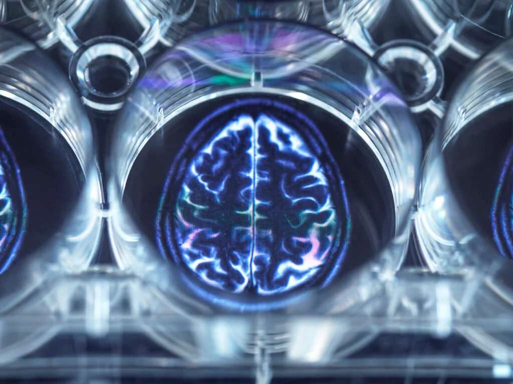 How does Psychotherapy effect the Brain?